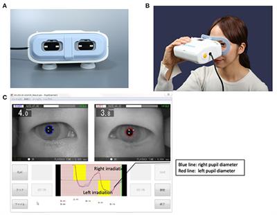 A Novel Method for Measuring the Pupil Diameter and Pupillary Light Reflex of Healthy Volunteers and Patients With Intracranial Lesions Using a Newly Developed Pupilometer